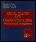 facial clefts and craniosynostosis. Principles and management